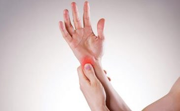 Carpel-Tunnel-Syndrome